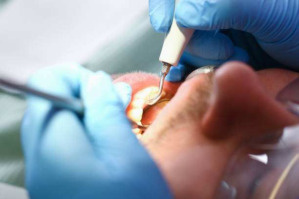 Best Broken or Cracked Tooth Emergency Dentist in Millport, AL